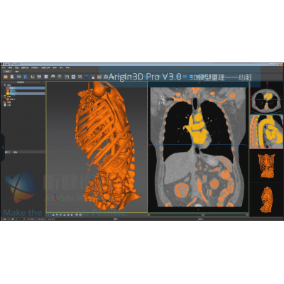 基于Arigin3D Pro V3.0的心臟模型重建